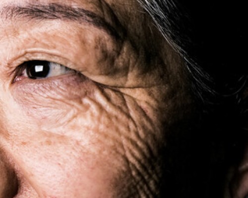 Senior asian woman eye