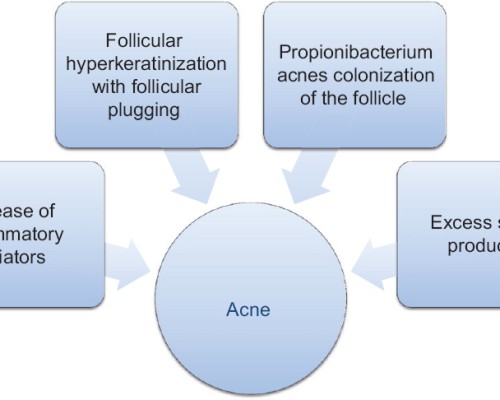 acne cycle